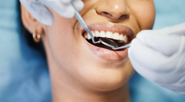 Best Emergency Denture Repair in Manly, IA