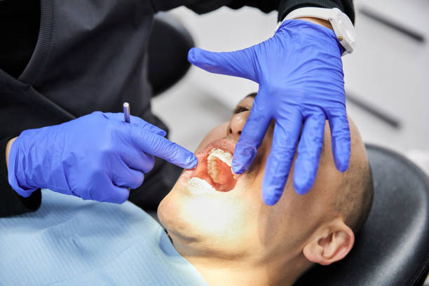 Best Emergency Wisdom Tooth Extraction in Manly, IA
